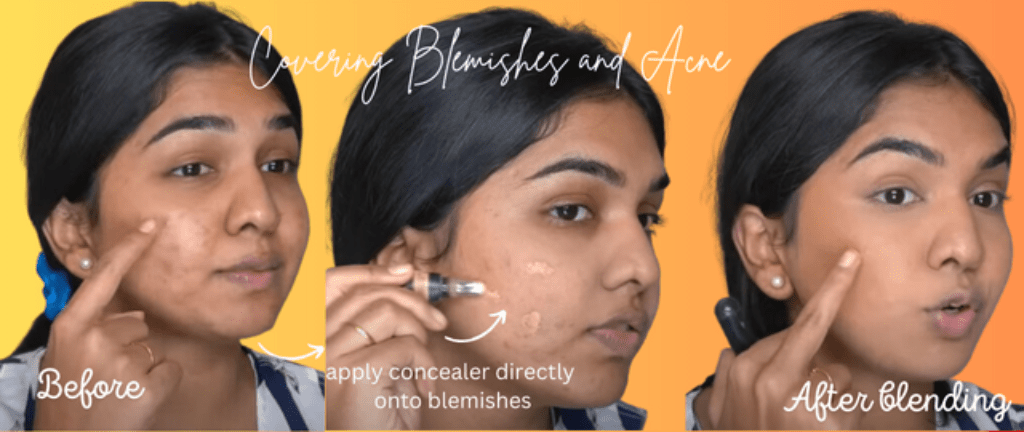 Covering Blemishes and Acne